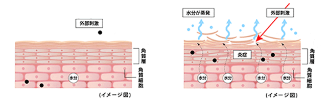 外部刺激 水分保持 角質層 角質細胞（イメージ図） 外部刺激 炎症 水分が蒸発 角質層 角質細胞（イメージ図）